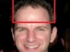 tyler-balding