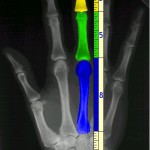 Hand Fibonacci