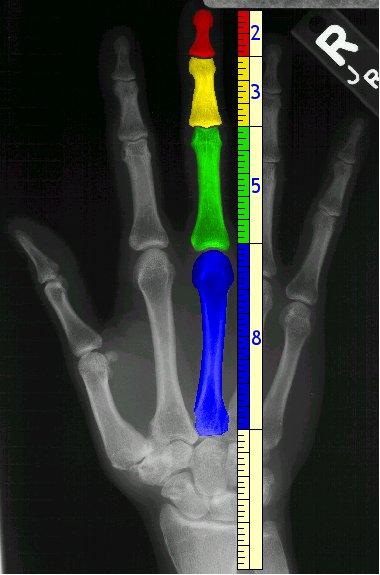  ... you know that the bones in your hand represent the FIBONACCI SEQUENCE